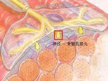 运动性骨骼肌微损伤机制的研究进展