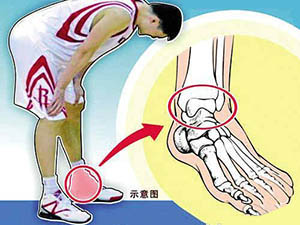 生机勃勃的骨骼肌肉系统